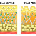 Le rughe: prevenzione e rimedi per curare la nostra pelle