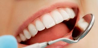 La Parodontite, ecco come può essere tenuta sotto controllo