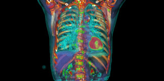 Inaugurati i primi webinar in radiologia oncologica