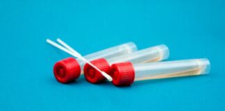 Covid 19: ecco le differenze tra test sierologico, test rapido e tampone